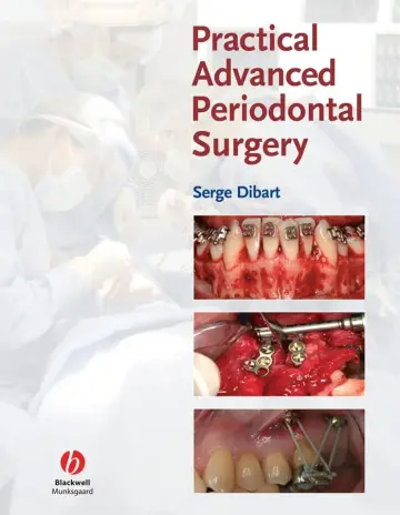 Cover of Practical Advanced Periodontal Surgery