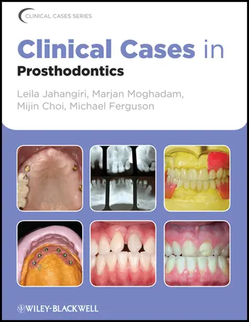 Cover of Clinical Cases in Prosthodontics (Clinical Cases (Dentistry))