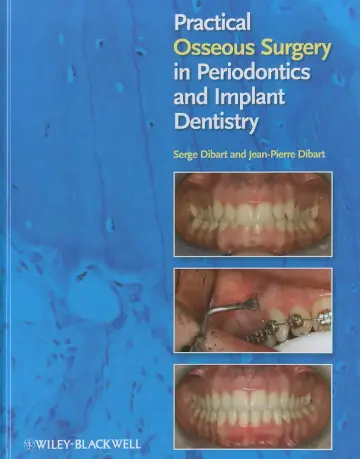 Cover of Practical Osseous Surgery in Periodontics and Implant Dentistry