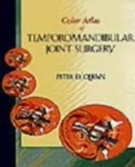 Cover of Color Atlas of Temporomandibular Joint Surgery