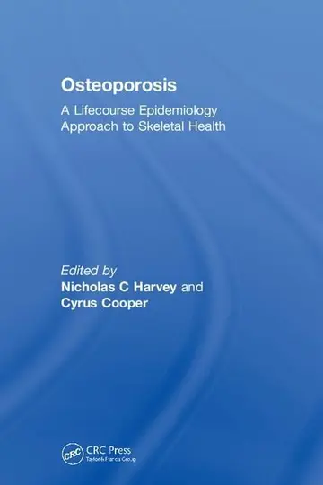 Cover of Osteoporosis