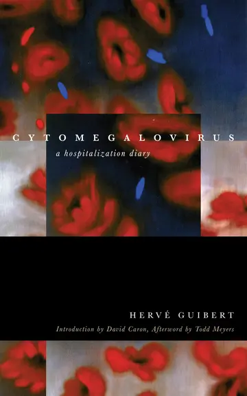 Cover of Cytomegalovirus
