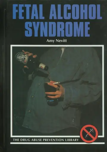 Cover of Fetal Alcohol Syndrome