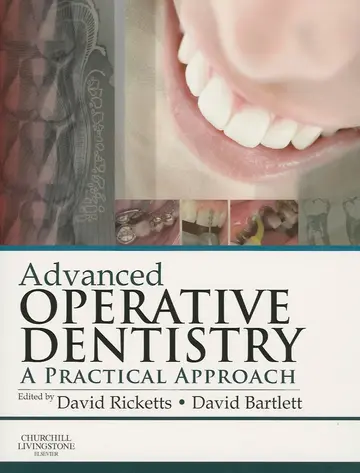 Cover of Advanced Operative Dentistry