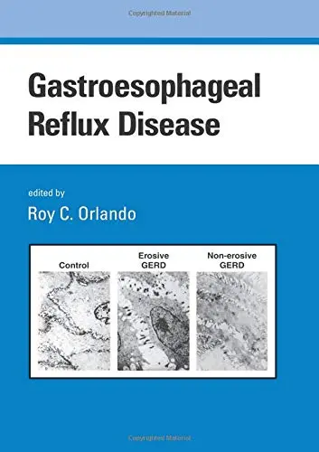 Cover of Gastroesophageal Reflux Disease