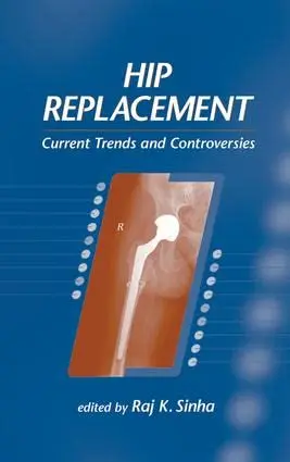 Cover of Hip Replacement