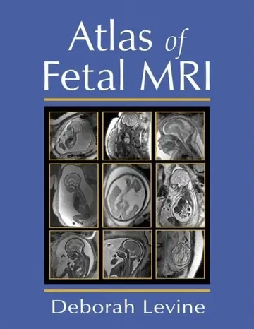 Cover of Atlas of Fetal Mri