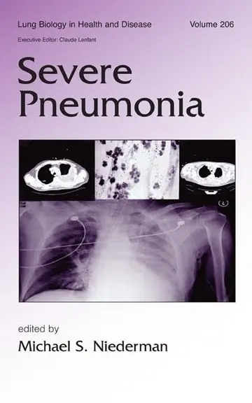 Cover of Severe Pneumonia