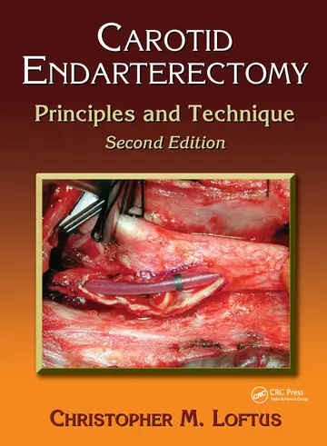 Cover of Carotid Endarterectomy