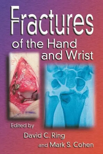 Cover of Fractures of the Hand and Wrist