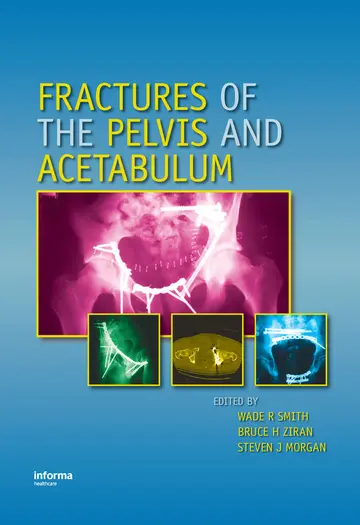 Cover of Fractures of the Pelvis and Acetabulum