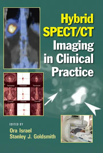 Cover of Hybrid Spect Ct Imaging in Clinical Practice