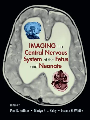 Cover of Imaging the Central Nervous System of the Fetus and Neonate