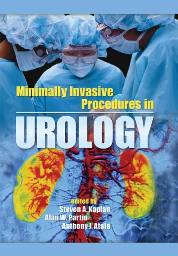 Cover of Minimally Invasive Procedures in Urology