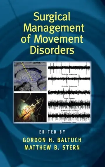 Cover of Surgical Management of Movement Disorders