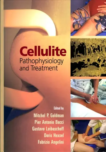 Cover of Cellulite