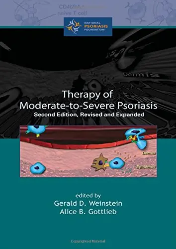 Cover of Therapy of Moderate-to-Severe-Psoriasis, Second Edition