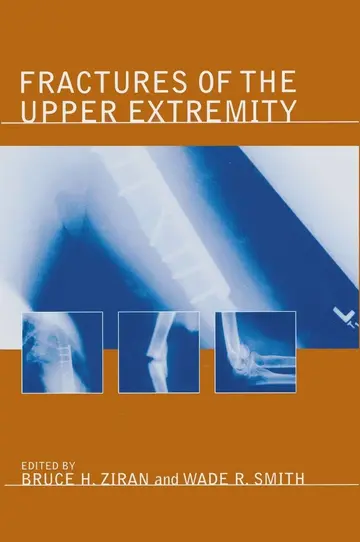 Cover of Fractures of the Upper Extremity