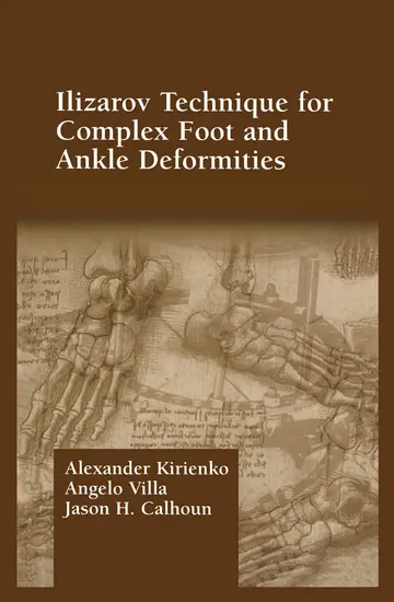 Cover of Ilizarov Technique for Complex Foot and Ankle Deformities