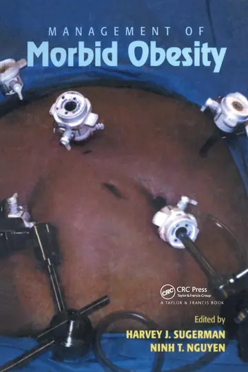 Cover of Management of Morbid Obesity