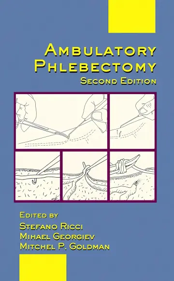 Cover of Ambulatory phlebectomy