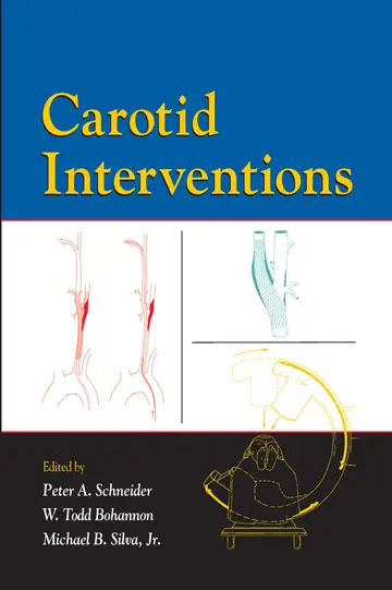 Cover of Carotid Interventions