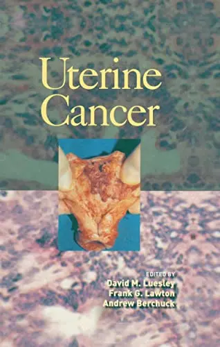 Cover of Uterine Cancer