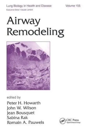 Cover of Airway Remodeling, Vol. 155