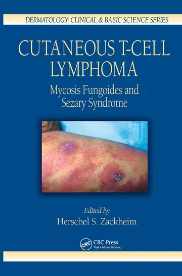 Cover of Cutaneous T-Cell Lymphoma