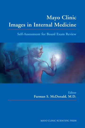 Cover of Mayo Clinic Images in Internal Medicine