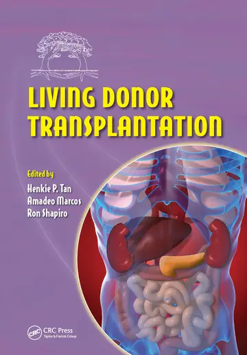 Cover of Living Donor Transplantation