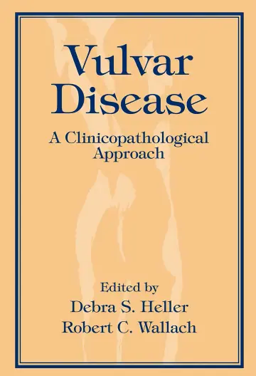 Cover of Medical Management of Chronic Myelogenous Leukemia