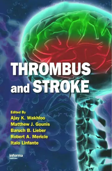 Cover of Thrombus and Stroke