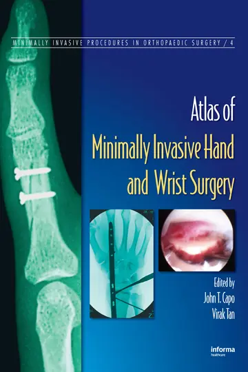 Cover of Atlas of Minimally Invasive Hand and Wrist Surgery