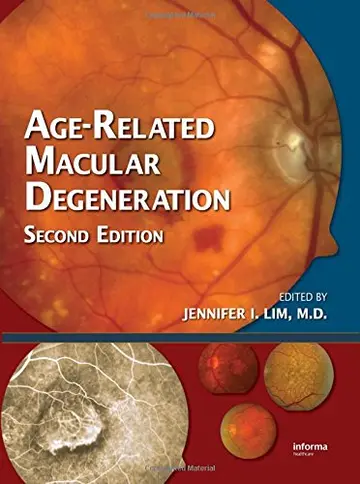 Cover of Age-Related Macular Degeneration, Second Edition