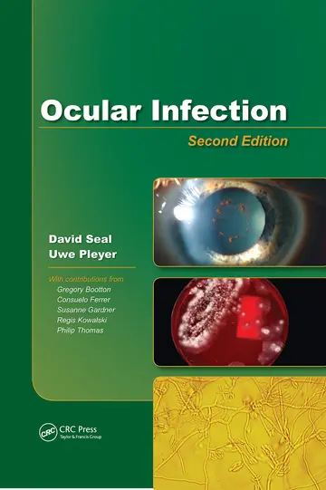 Cover of Ocular Infection 2ed (hb 2008)