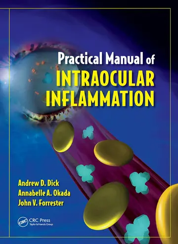 Cover of Practical Manual of Intraocular Inflammation