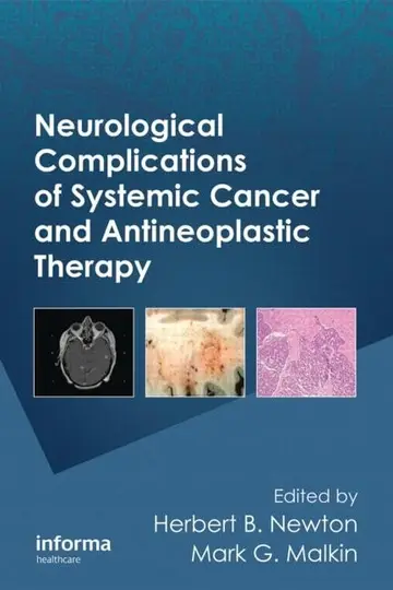 Cover of Neurological Complications of Systemic Cancer and Antineoplastic Therapy (96)