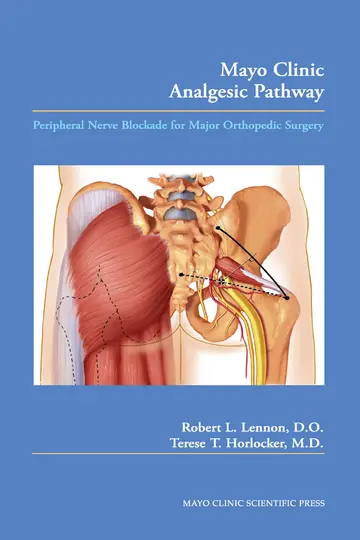 Cover of Mayo Clinic Analgesic Pathway Peripheral Nerve Blockade for Major