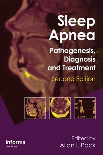 Cover of Sleep Apnea