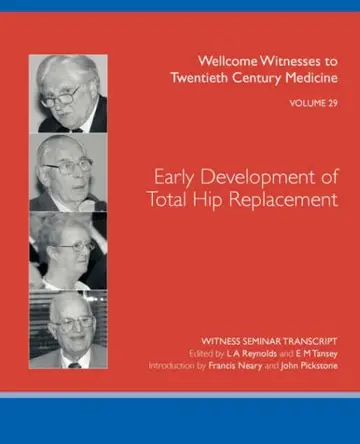 Cover of Early Development of Total Hip Replacement