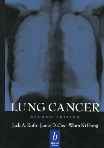 Cover of Lung Cancer