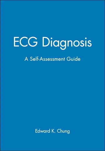 Cover of ECG Diagnosis A Self-Assessment Workbook