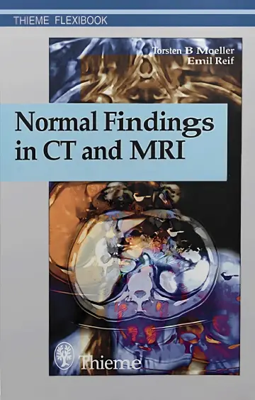 Cover of Normal Findings in Ct and Mri