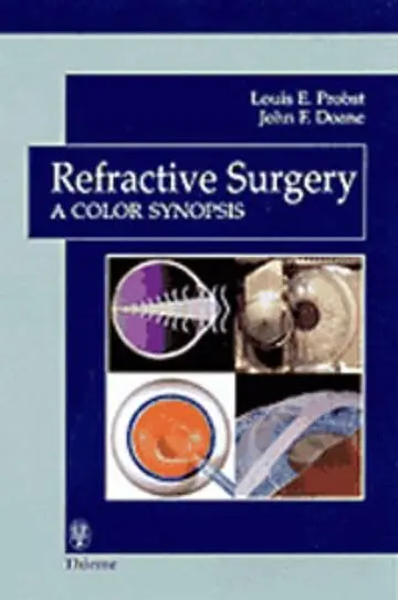 Cover of Refractive Surgery