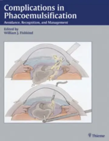 Cover of Complications in Phacoemulsification