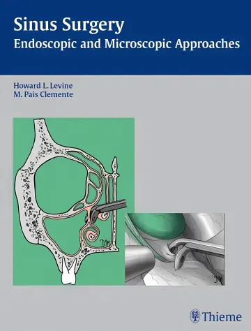 Cover of Sinus Surgery