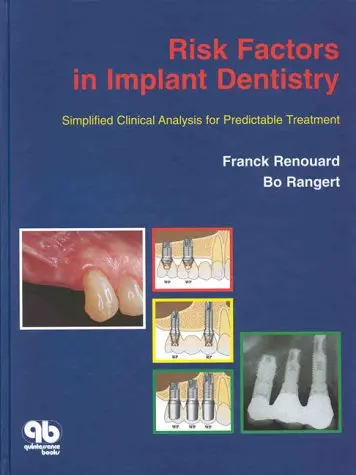 Cover of Risk Factors in Implant Dentistry
