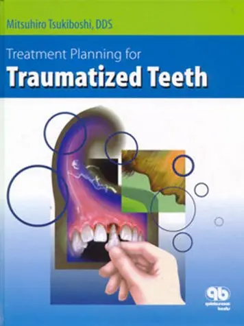 Cover of Treatment Planning for Traumatized Teeth