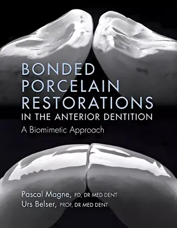 Cover of Bonded Porcelain Restorations in the Anterior Dentition